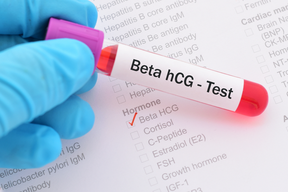 Beta HCG değeri 2.3 ne demek?